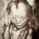 Illustration for article titled See The Worlds Youngest In-Utero Smile